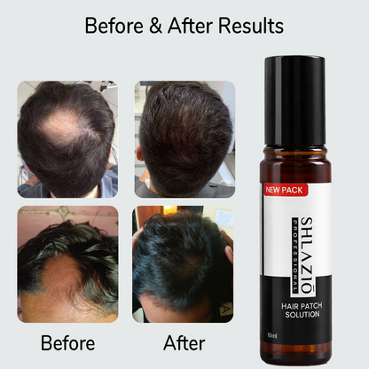 Hair Patch Roll - On | #1 Highly Rated & Effective Formula