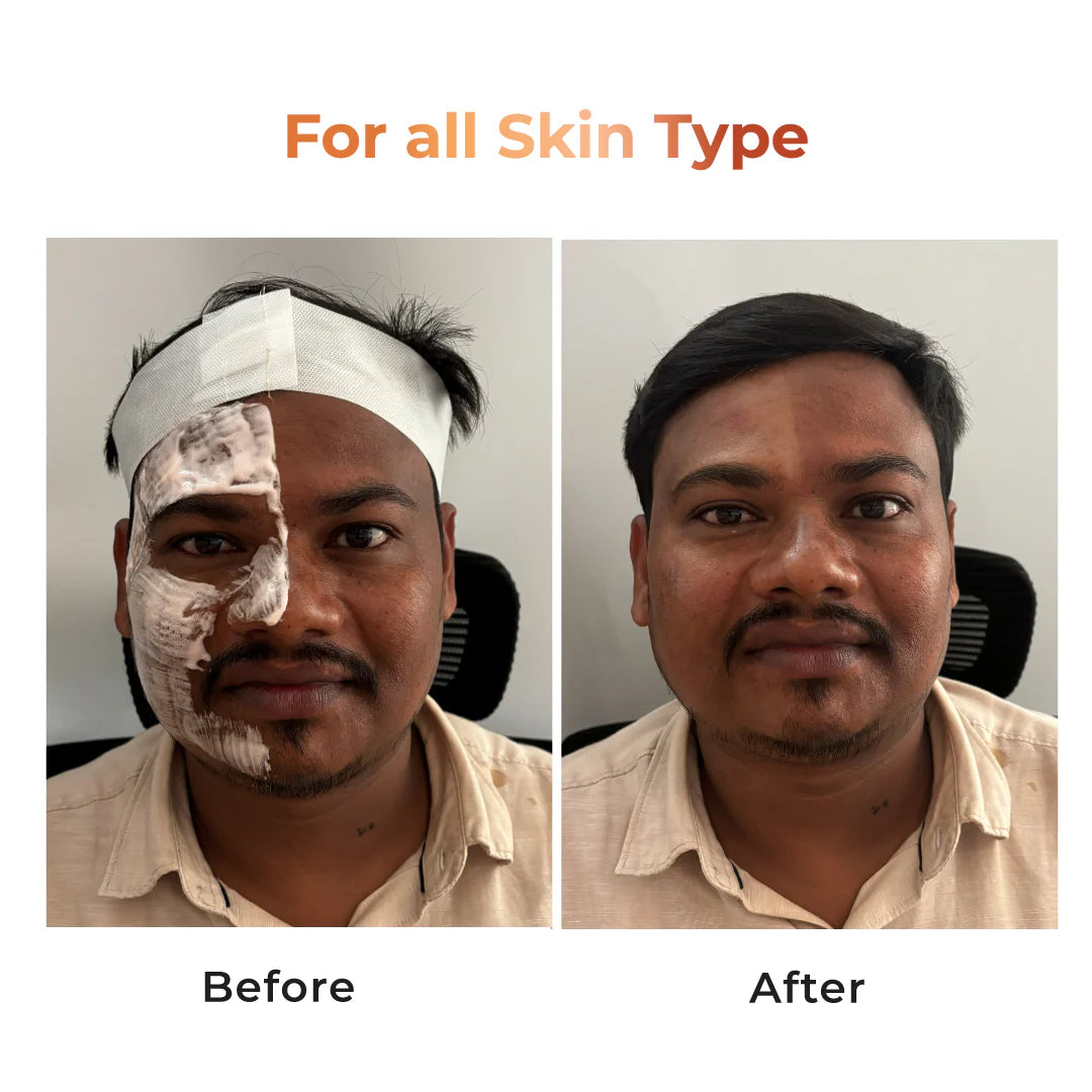 Whitening cleanser