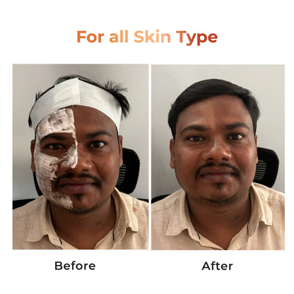 Whitening cleanser