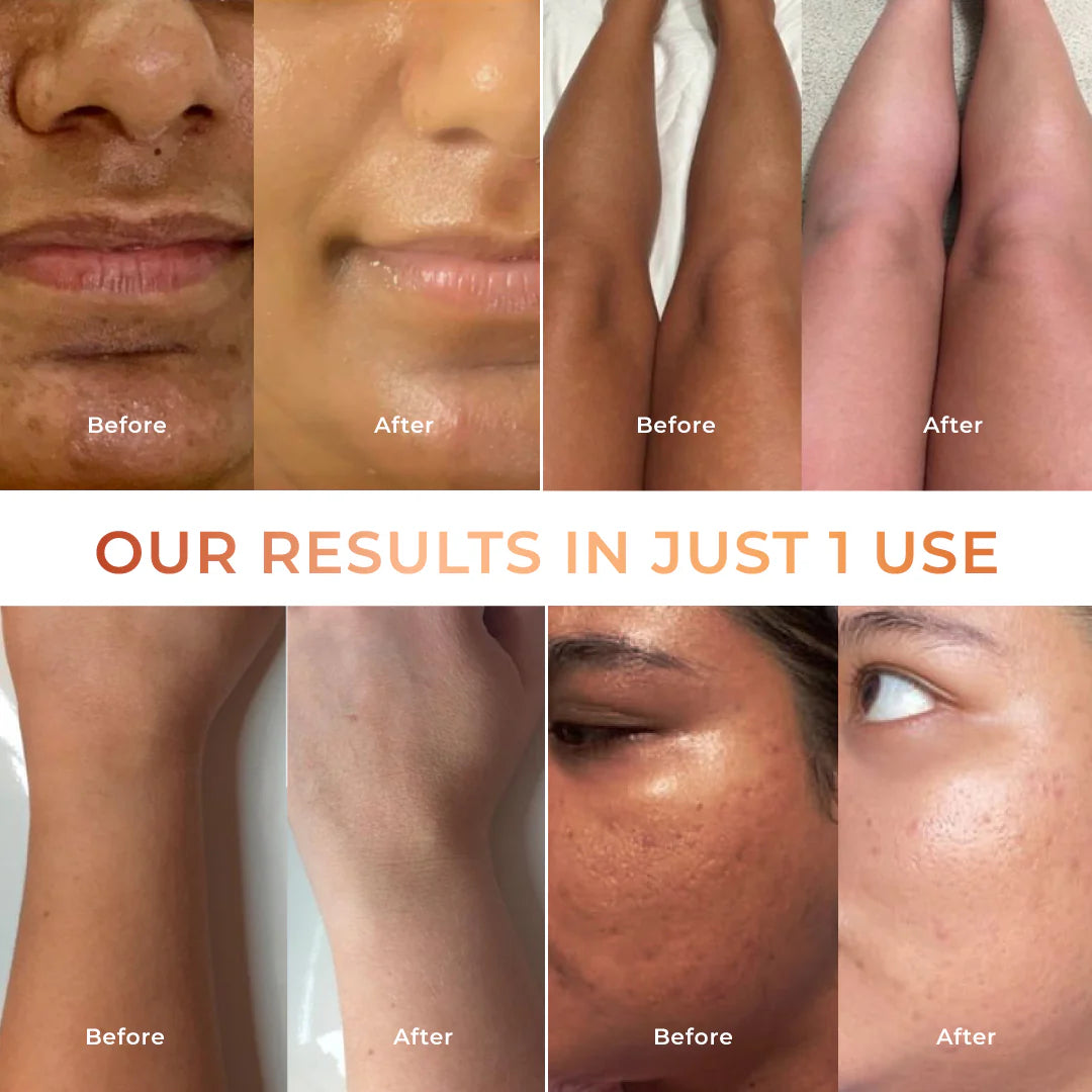 Whitening cleanser
