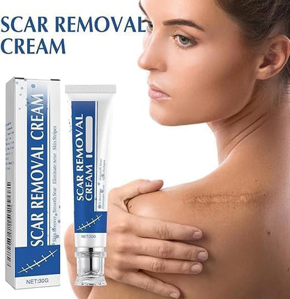 Scar removal cream