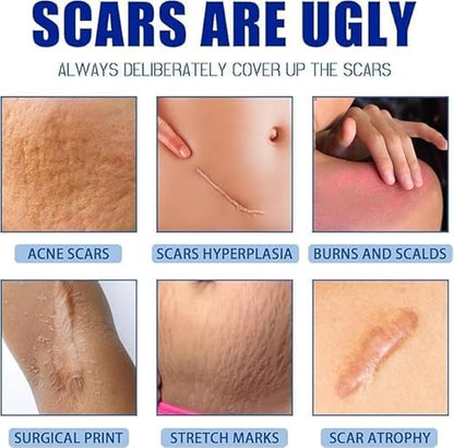 Scar removal cream