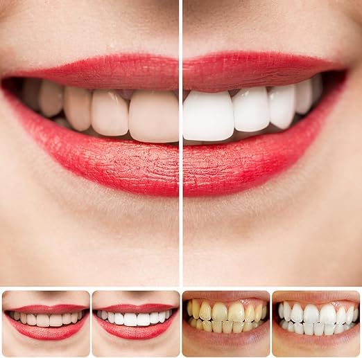 SP 4 Ultra Whitening Toothpaste